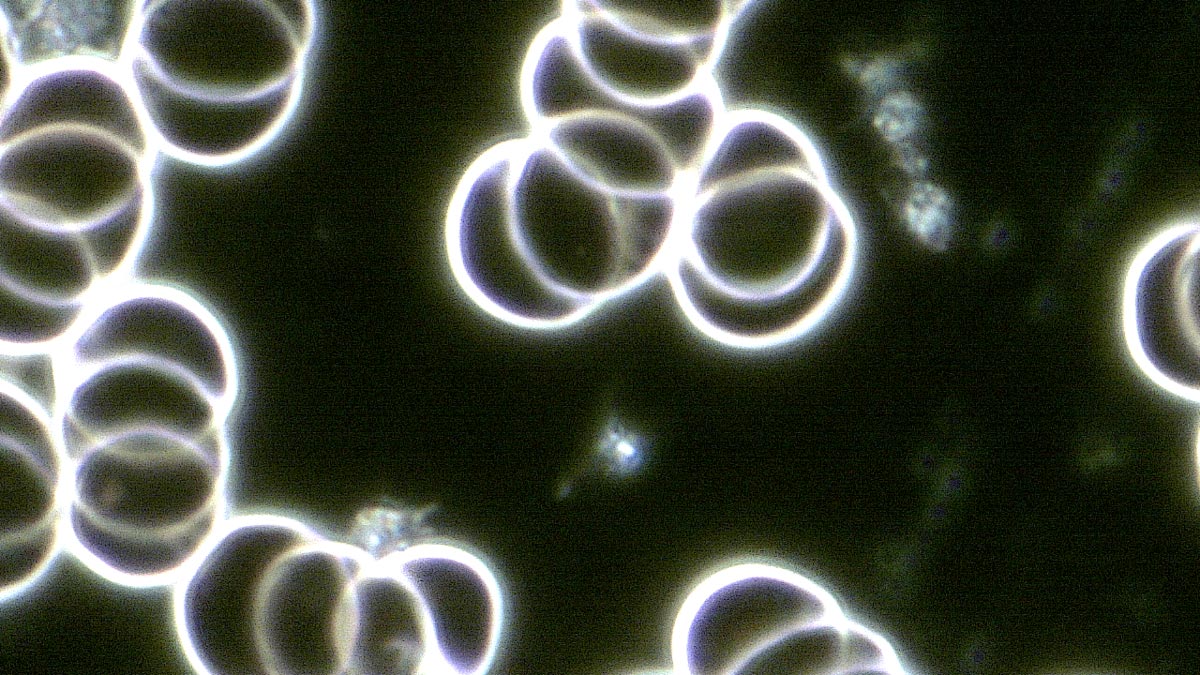 Blutkörperchen unter dem Dunkelfeldmikroskop