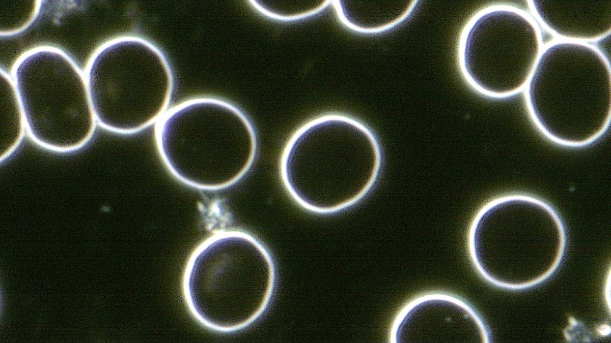Blutkörperchen unter dem Dunkelfeldmikroskop